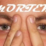 Avatar de MORTEM