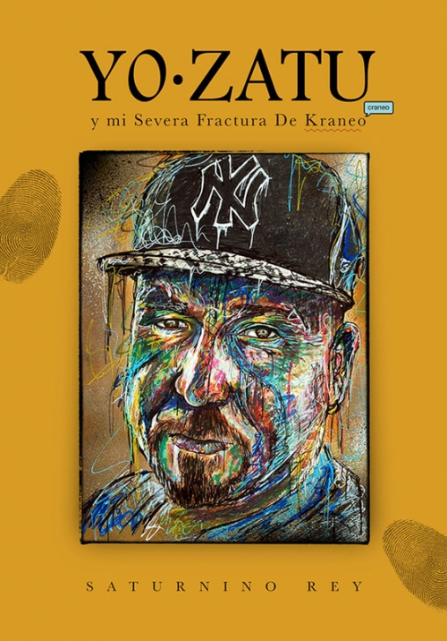 Yo zatu y mi severa fractura de kraneo