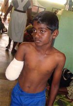 Niño herido en Sri Lanka